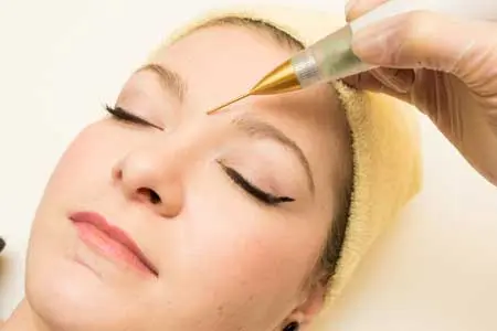 Jett Plasma Lift el tratamiento definitivo