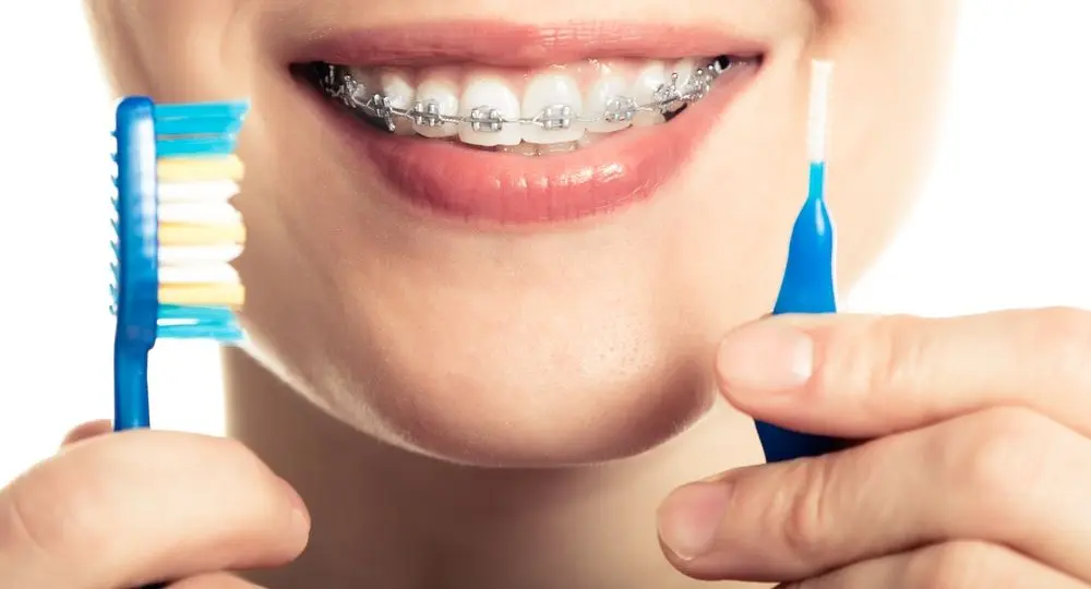 Tratamiento de ortodoncia con brackets para cuidar tu sonrisa en clínica dental en Los Cristianos, Tenerife.