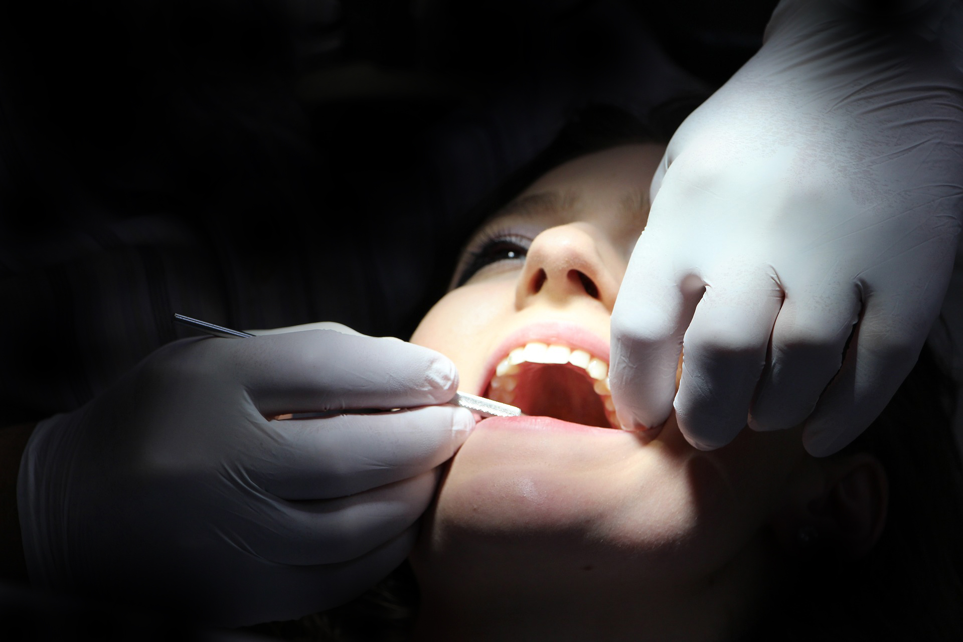 Bacterias orales, periodontitis y cáncer de páncreas, una estrecha relación