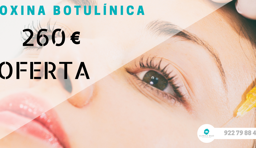 Oferta: Tratamiento con toxina Botulínica por 260€