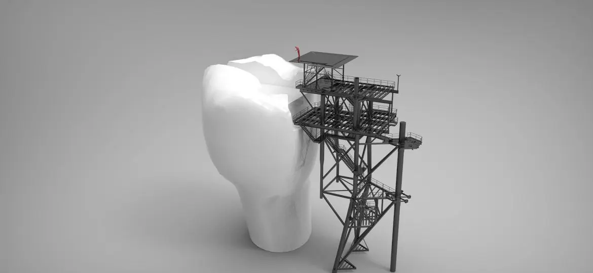 - Clínica Bajo Bruxismo: Qué es y cómo podemos combatirlo