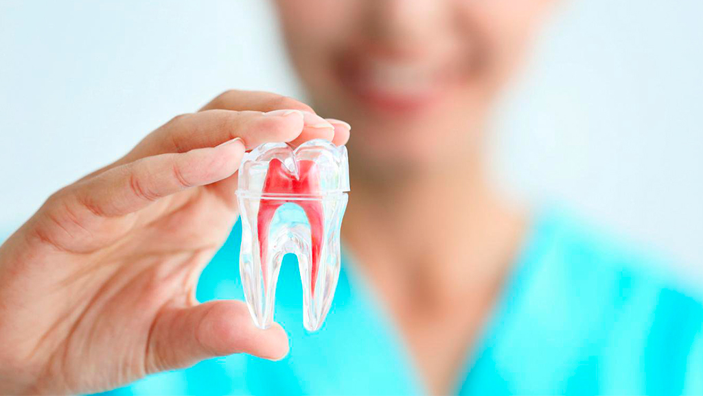 Consejos para el cuidado bucal después de una endodoncia