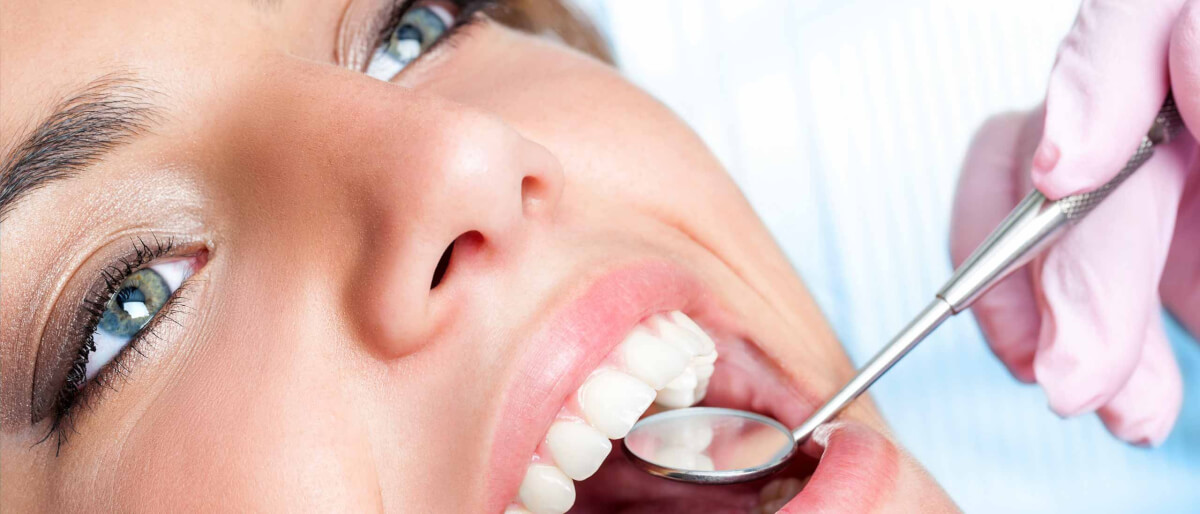 Beneficios de una limpieza dental profesional
