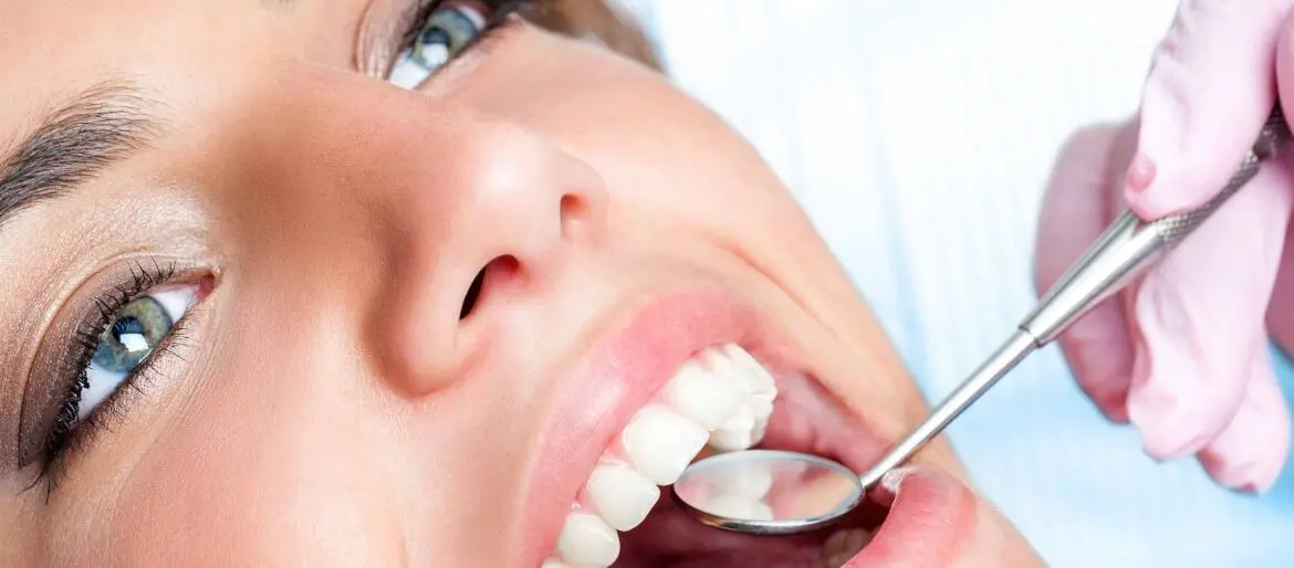 limpieza dental - Clínica Bajo Beneficios de una limpieza dental profesional