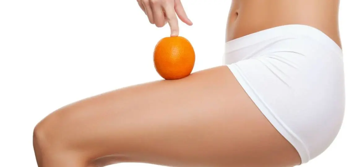 Mesoterapia. La mejor solución para la celulitis