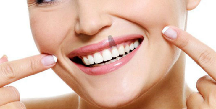 Implantes dentales, ¿cómo los cuidamos en el día a día?