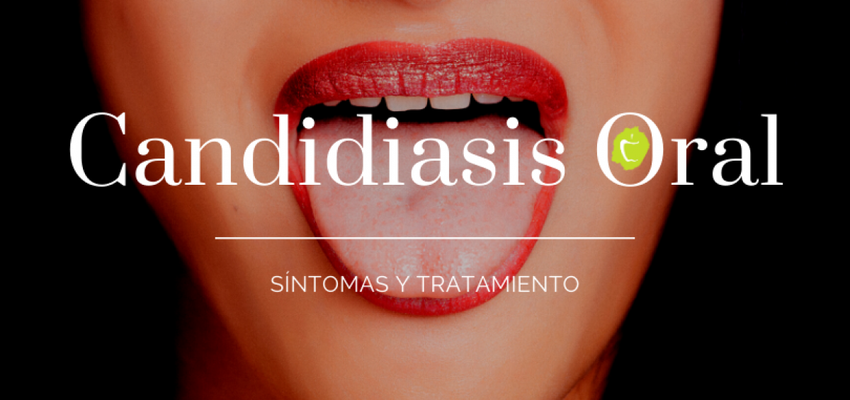 candidiasis bucal causas y tratamiento