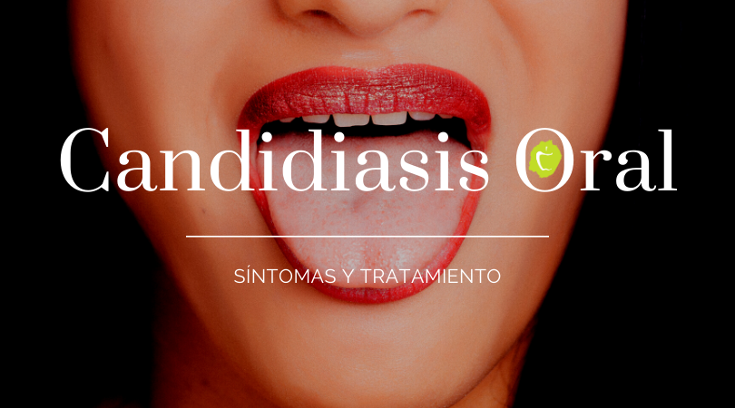 Candidiasis oral, síntomas y tratamiento