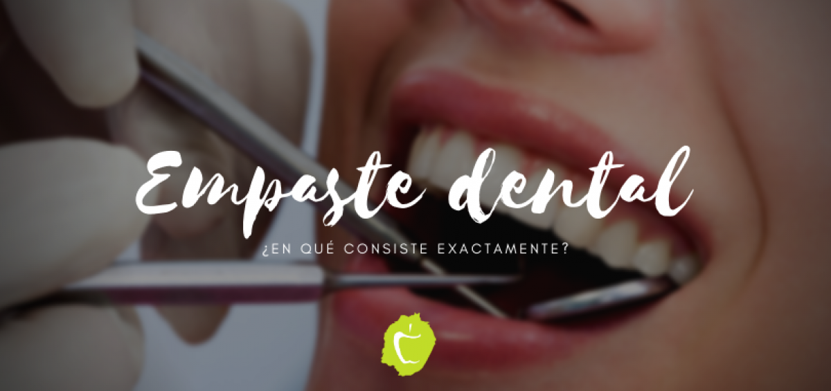 Empaste dental, ¿en qué consiste exactamente? Clínica Dental Bajo