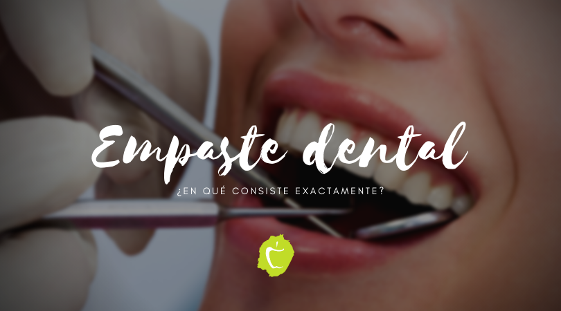 Empaste dental, ¿en qué consiste exactamente?