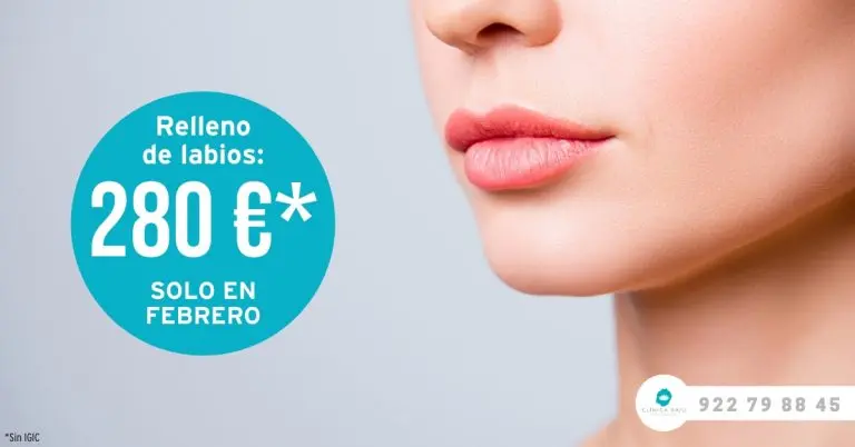 Relleno de labios en Tenerife - Clínica Bajo Relleno de labios con ácido hialurónico para mejorar el volumen y la forma en clínica estética de Tenerife