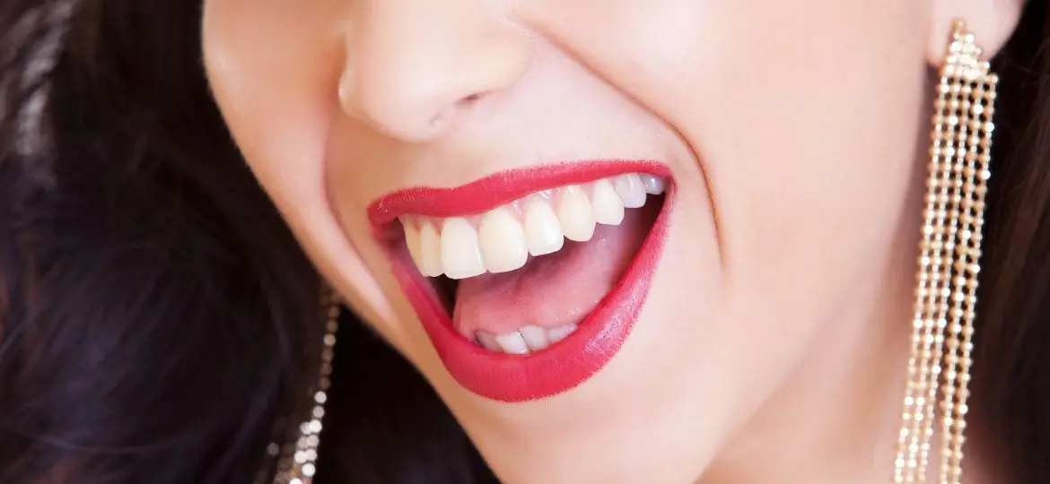 Blanqueamiento dental: cuidados antes y después del tratamiento