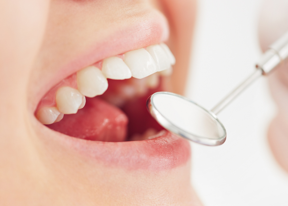 Preventing cavities and improving oral health