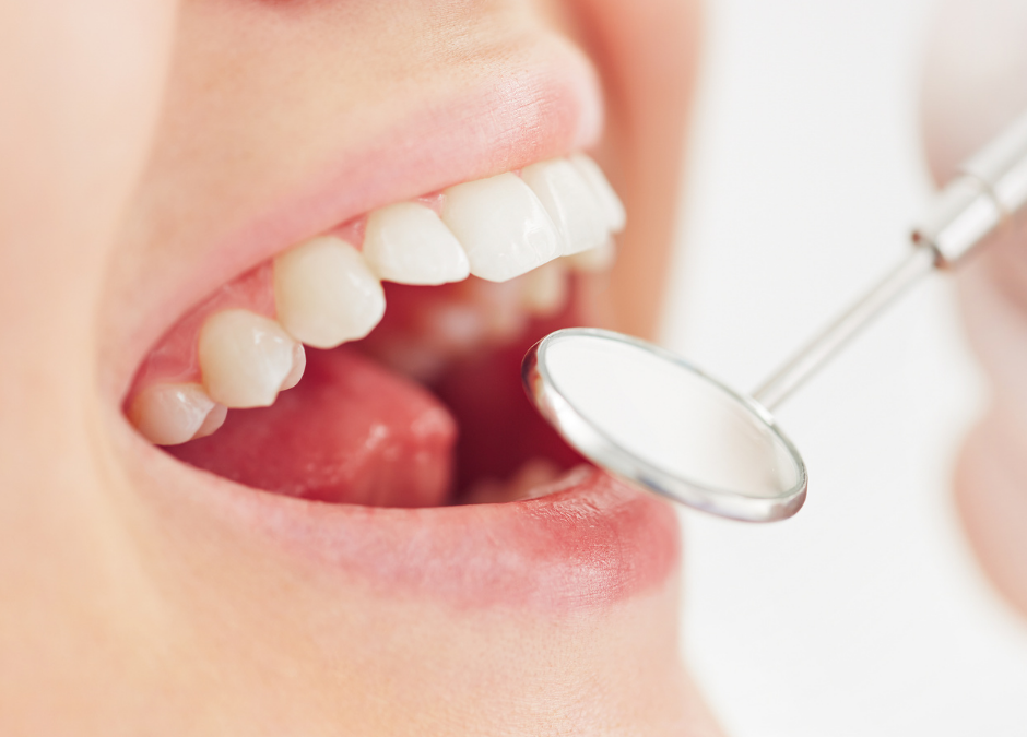 Prevenir las caries y mejorar la salud bucodental