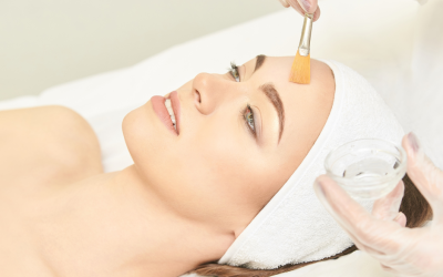 Peeling profesional, ¿cómo y cuándo hacérselo?