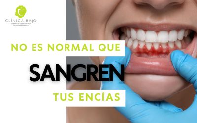 ¿Por qué sangran tus encías?