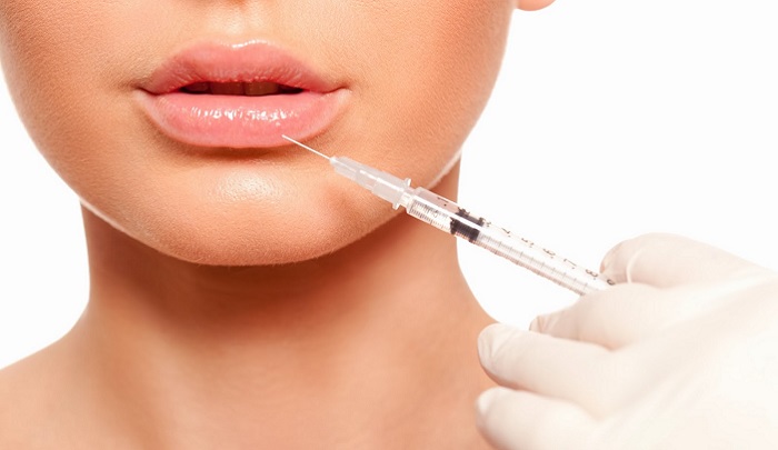 Aumento de labios sin cirugía. Las preguntas más frecuentes