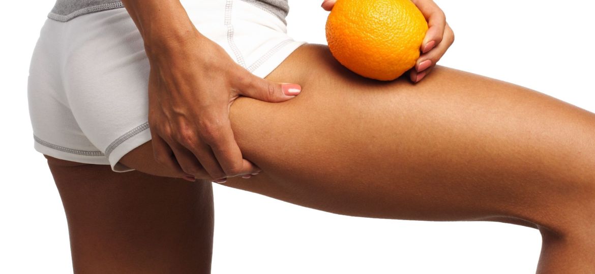 Elimina la celulitis con los mejores tratamientos