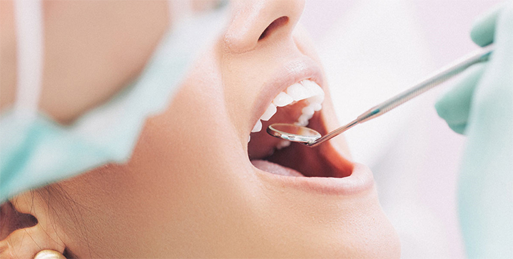 Endodoncia o empaste