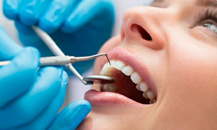 Incrustación dental