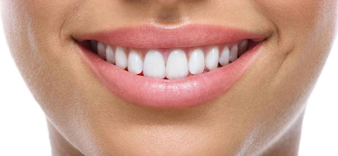 La importancia de una sonrisa saludable