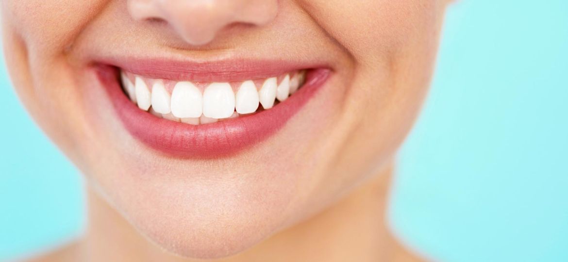 Todo lo que debes saber sobre el blanqueamiento dental