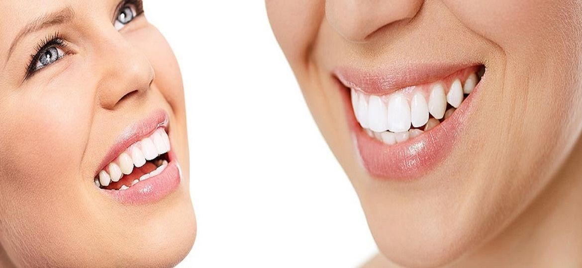 Este verano tus dientes se visten de blanco