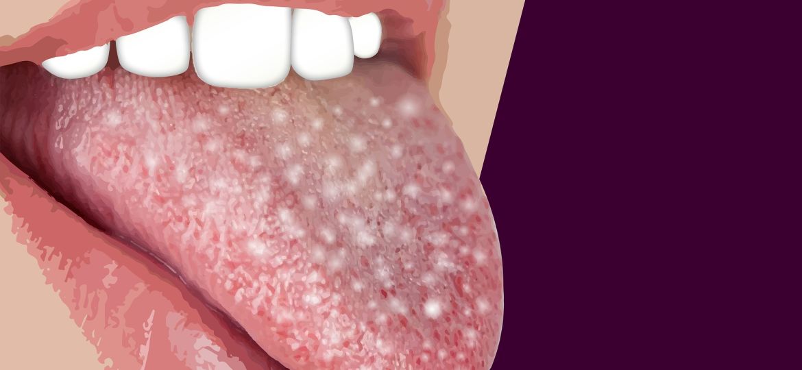 ¿Cómo debemos limpiarnos la lengua?