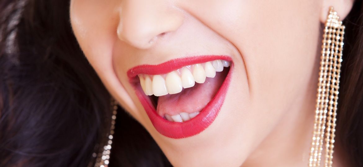 Blanqueamiento dental: cuidados antes y después del tratamiento