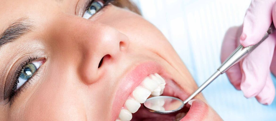 Beneficios de una limpieza dental profesional