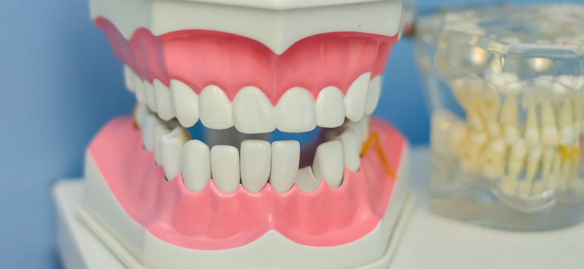 La relación entre la pérdida de los dientes y la pérdida de memoria