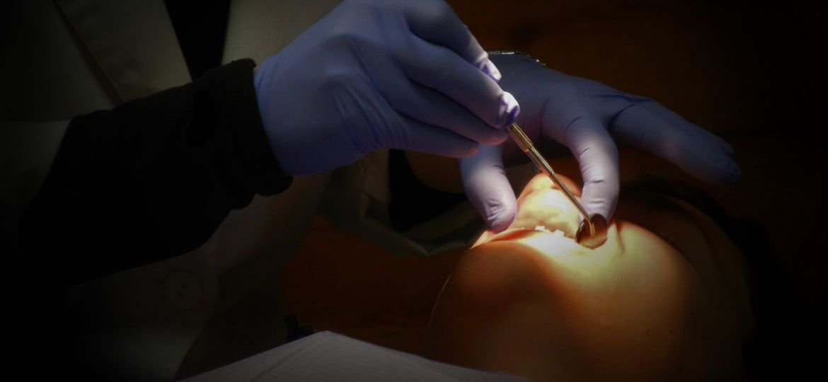 Periodontitis