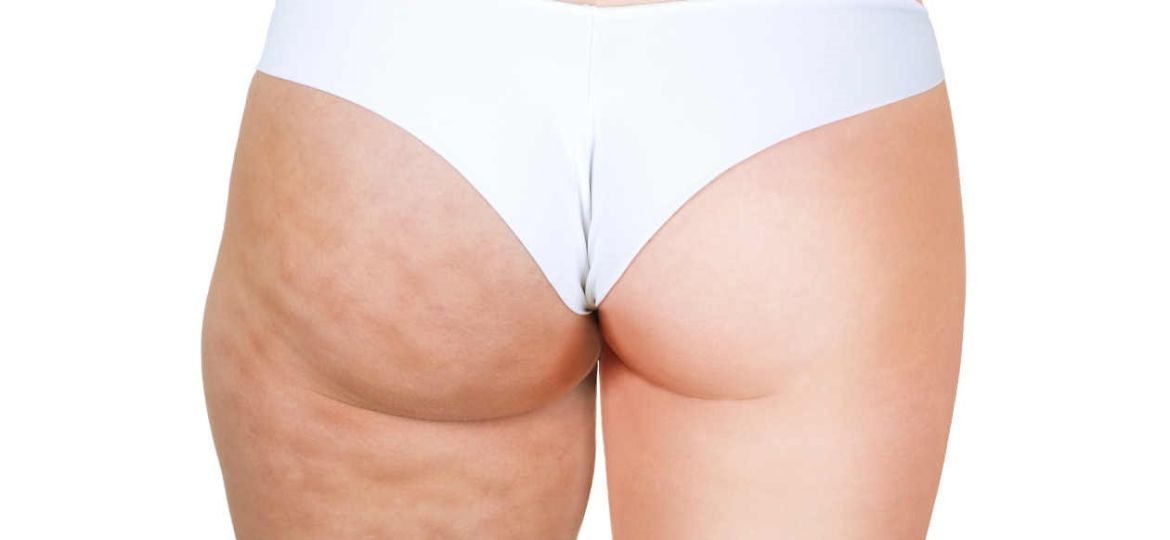 Tras la dieta