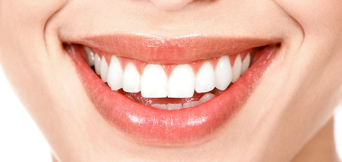 Tratamientos estéticos para una sonrisa perfecta