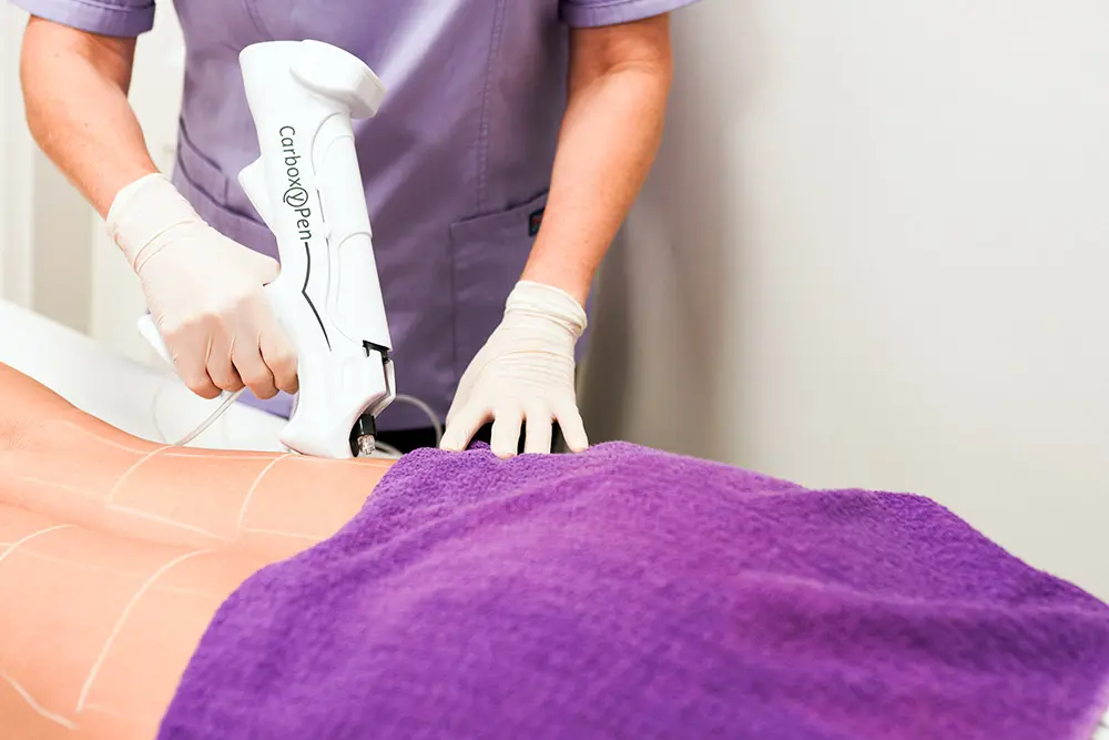 Tratamientos Corportales en Tenerife Sur - Clínica Bajo Body treatments in Tenerife South to reshape, firm and improve the appearance of the skin at Clinica Bajo, Los Cristianos